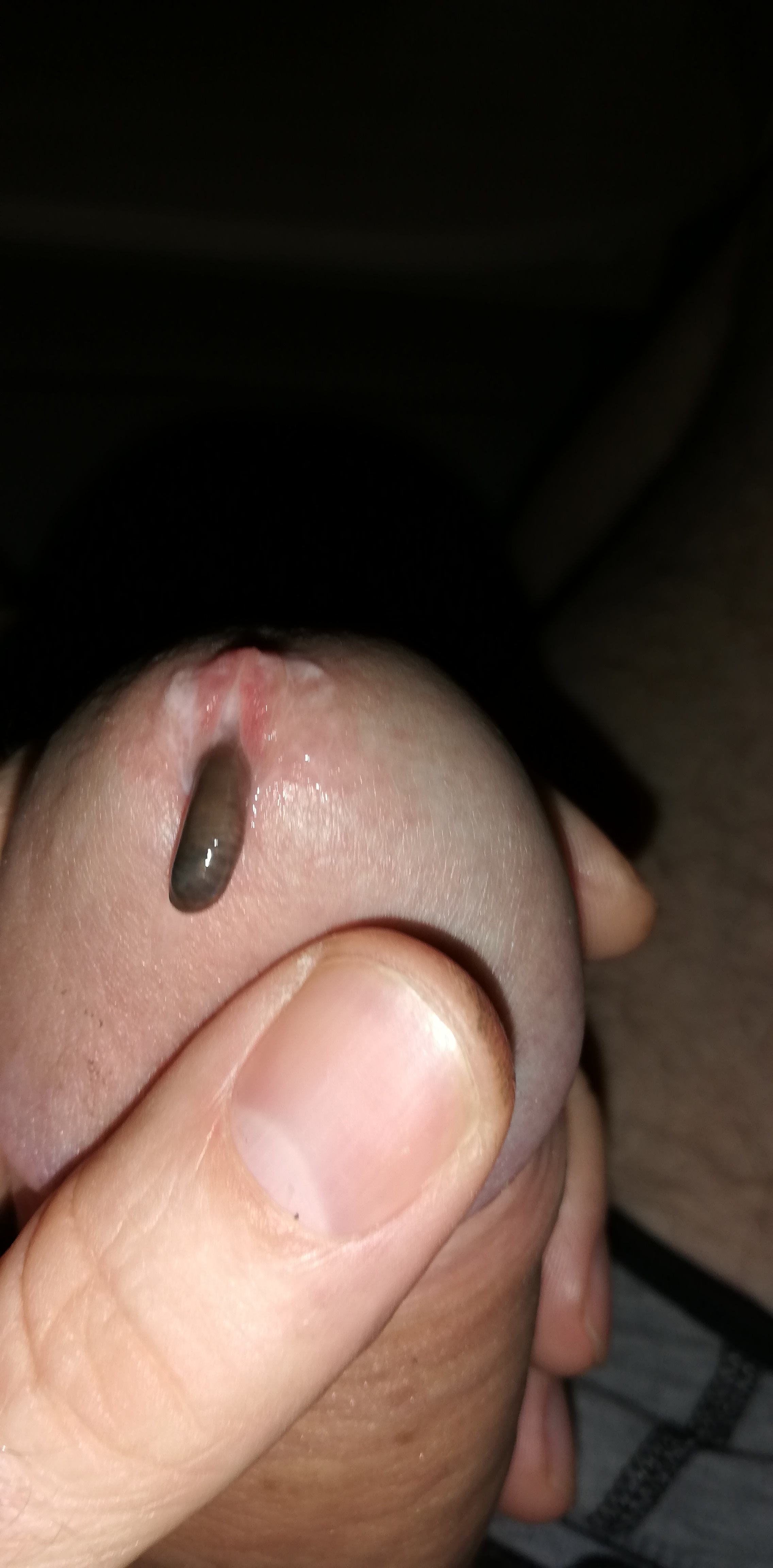 Game with worm — 11