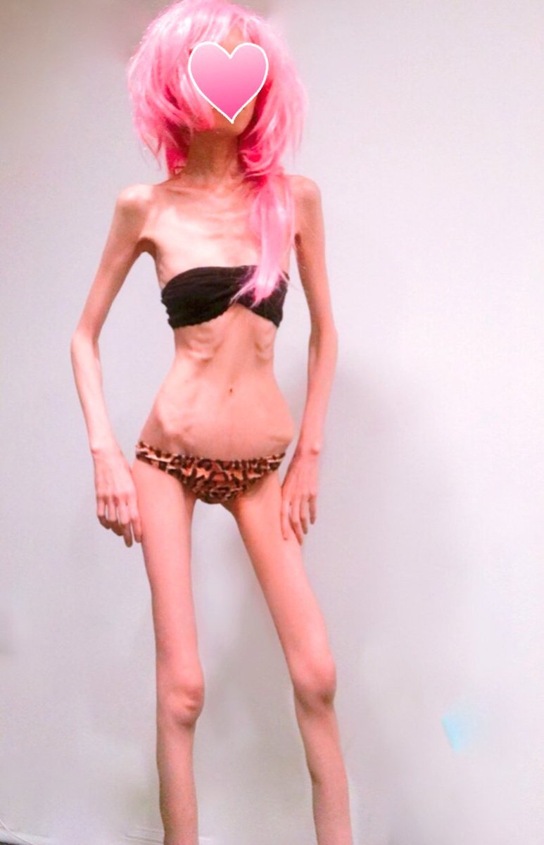 Bony Bitches:  You're Still Too Fat, Cunt! — 16