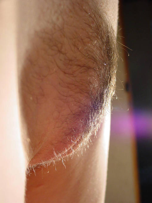 Hairy — 56